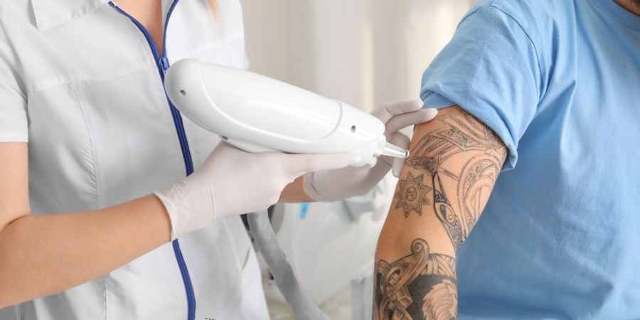 Tattoo Removal